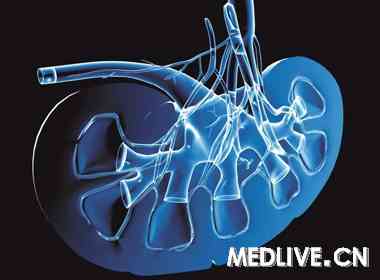 钆造影剂与肾源性系统性纤维化_造影剂肾病_