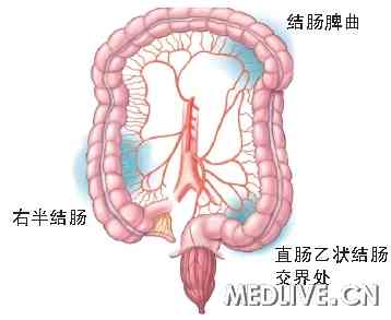 IC好发部