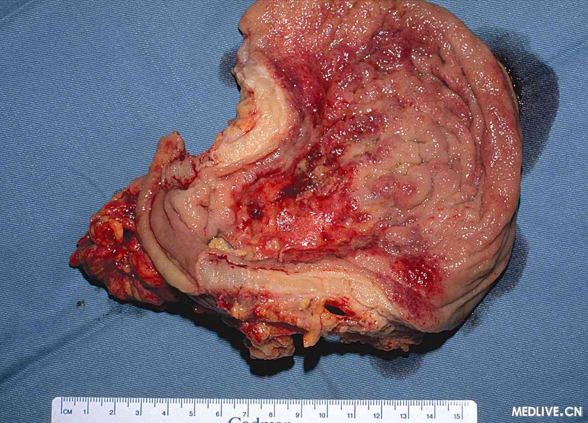 <em>中年女性</em>_<em>中年女性发型图片</em>_<em>中年女性</em>防衰老