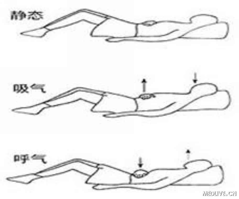 腹式呼吸练习对胃食管反流病的积极作用
