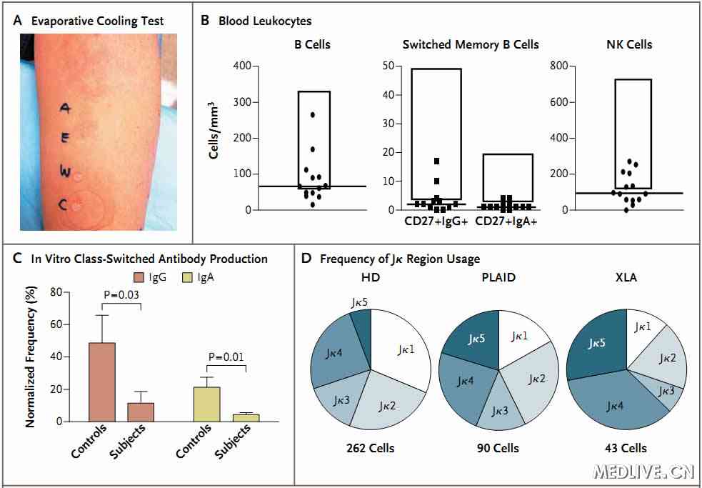 NEJM:寒冷性荨麻疹或为显性遗传病![附全文]