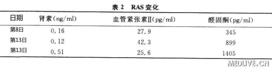 RAS