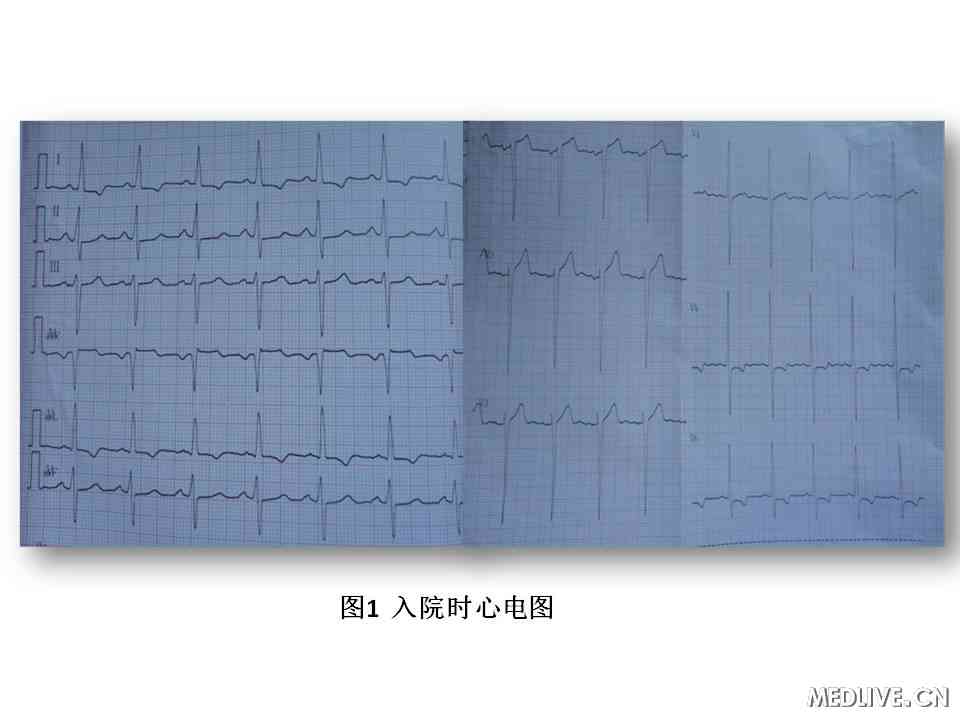 <a href='http://ask.999120.net/list_830_all/index.html' target=_blank>Ѫѹ</a>֢ľ