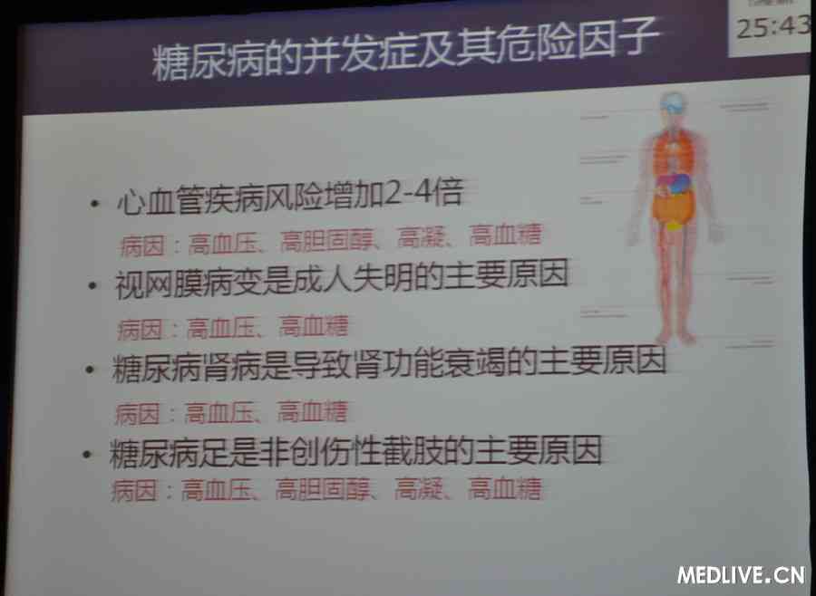 [PUDF2012]纪立农:指南和现实世界之间的差距