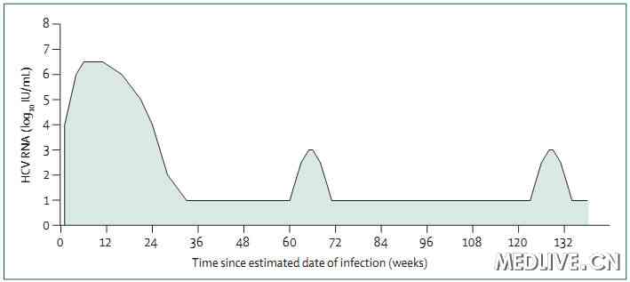 图 HCV的感染、清除及再感染（从首次感染开始）