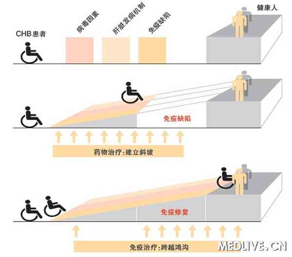  图：慢性乙肝抗病毒治疗的“爬坡假说” 