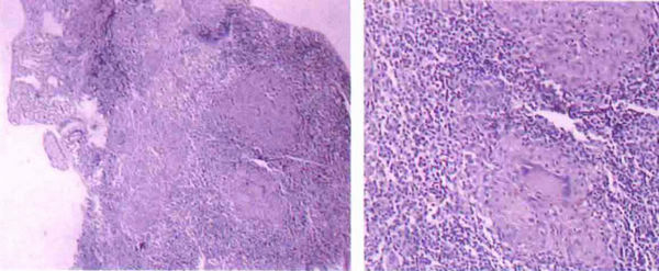 【答案公布】:年轻女性便秘8年如何确诊?