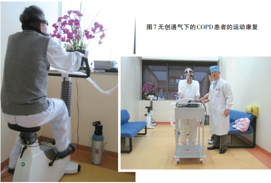 "动起来",助力慢阻肺患者肺康复