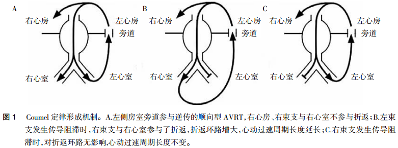 预激综合征:Coumel定律再认识