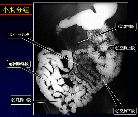 了解消化道的正常解剖(组图)_胃_大肠_小肠_正常解剖