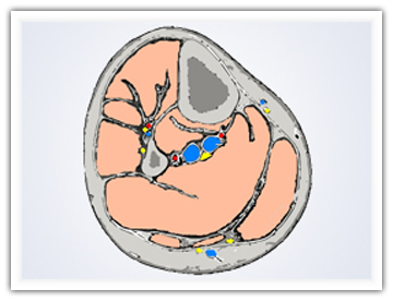 快速小测试:足下垂症状处理知多少