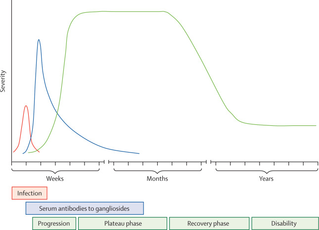 综述:吉兰-巴雷综合征(现状篇)