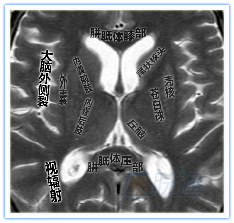 图片来自医脉通资讯频道:【简洁清晰的脑部特定区域断层解剖图谱】