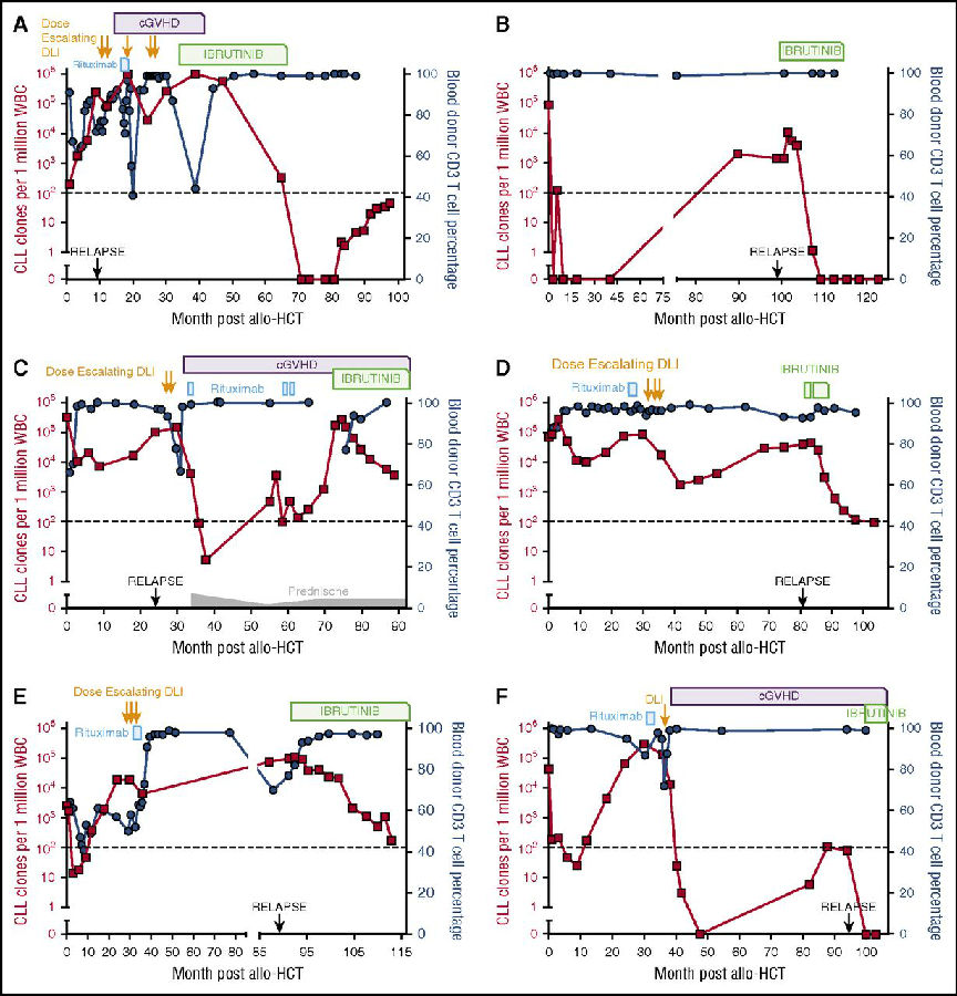 伊布替尼可否挽救alloHCT后复发的CLL患者?