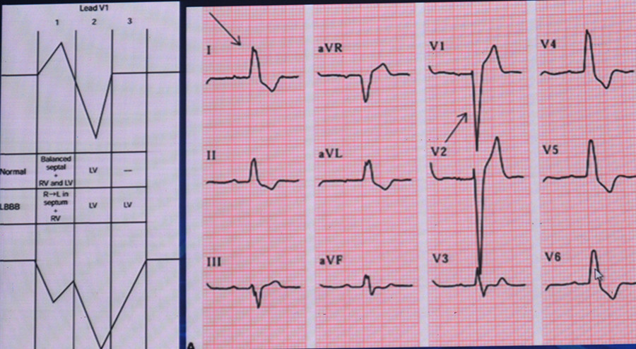[CHRS2017]盛琴慧:技多不压身,掌握多种宽QR