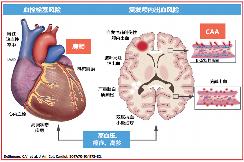 老年房颤患者的抗凝治疗,别忘了关注这种疾病