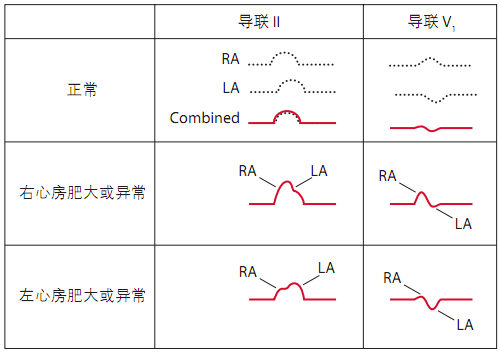 10分钟掌握标准心电图的基础知识