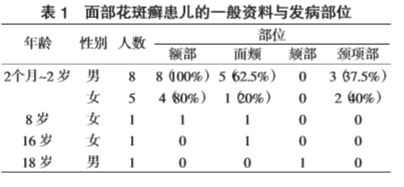 面部花斑癣 16 例临床分析