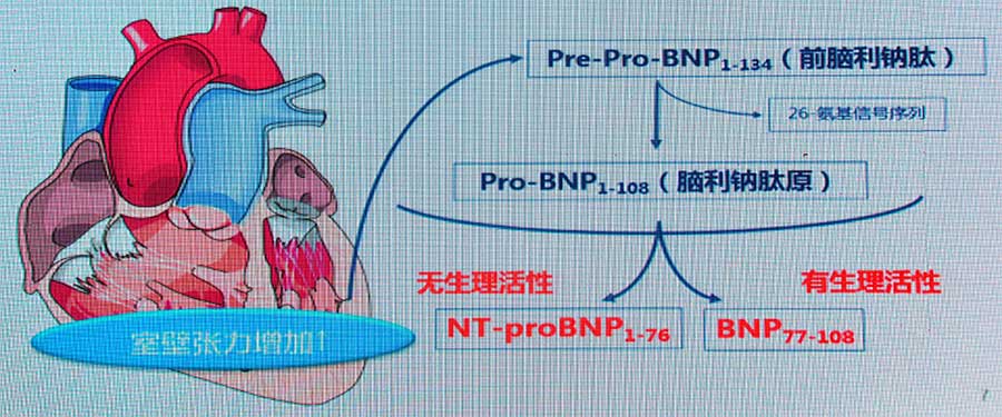 张宇辉教授:BNP和NT-proBNP在心力衰竭诊断