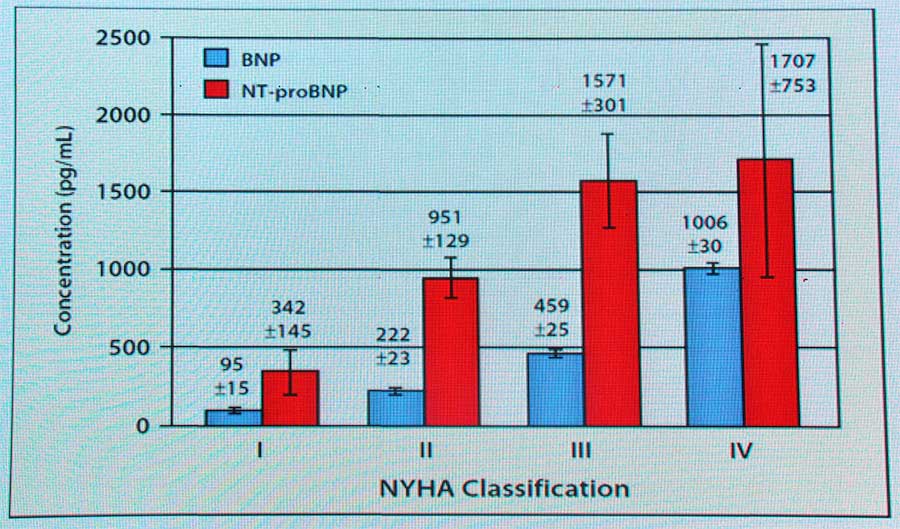 张宇辉教授:BNP和NT-proBNP在心力衰竭诊断