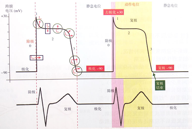 同一基因突变,为何向左为LQT3,向右为Brugad