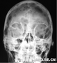 uploadfile/2012/0221/20120221024820539.png