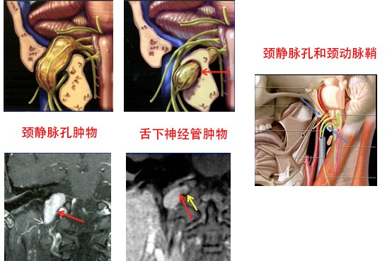 神经科基本功:颅底神经综合征的定位诊断,看这一篇就够了丨临床必备